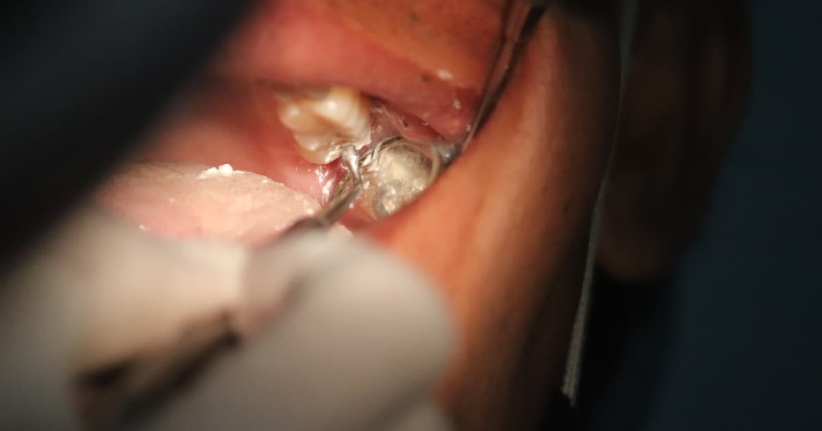 Продвижение стоматологии в Челябинске: маркетинг для клиник имплантации в промышленной столице Урала