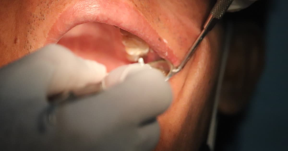 Продвижение стоматологии в Краснодаре: маркетинг для клиник имплантации в столице Кубани