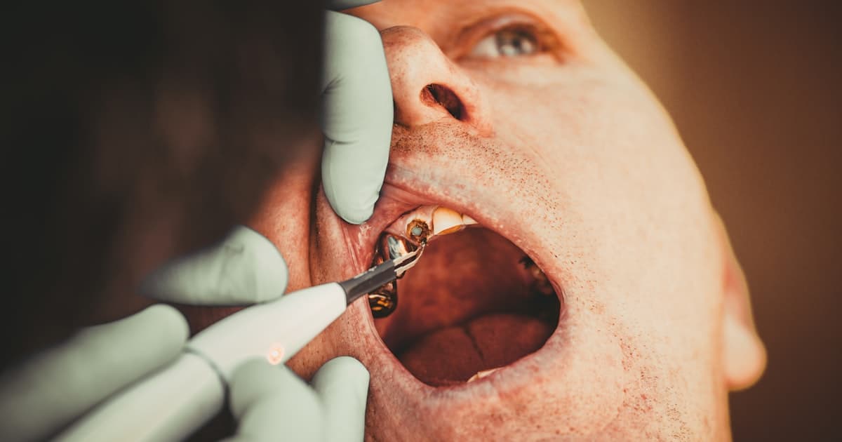 Продвижение стоматологии в Новосибирске: как привлечь пациентов на имплантацию в столице Сибири