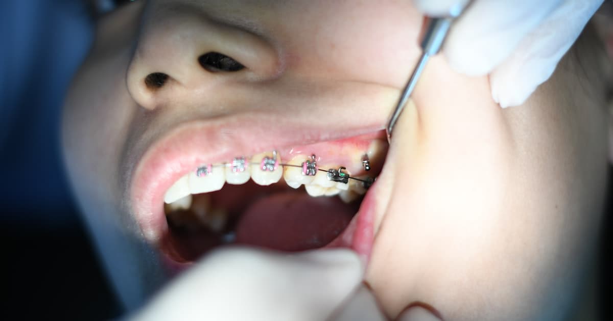 Продвижение стоматологии в Сочи: маркетинг для клиник имплантации в главном курорте России