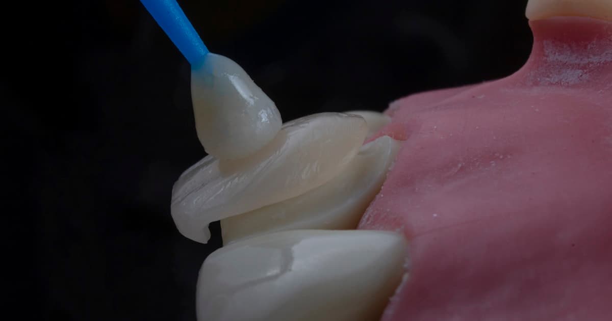 Продвижение стоматологии во Владимире: маркетинг для клиник имплантации в городе Золотого кольца